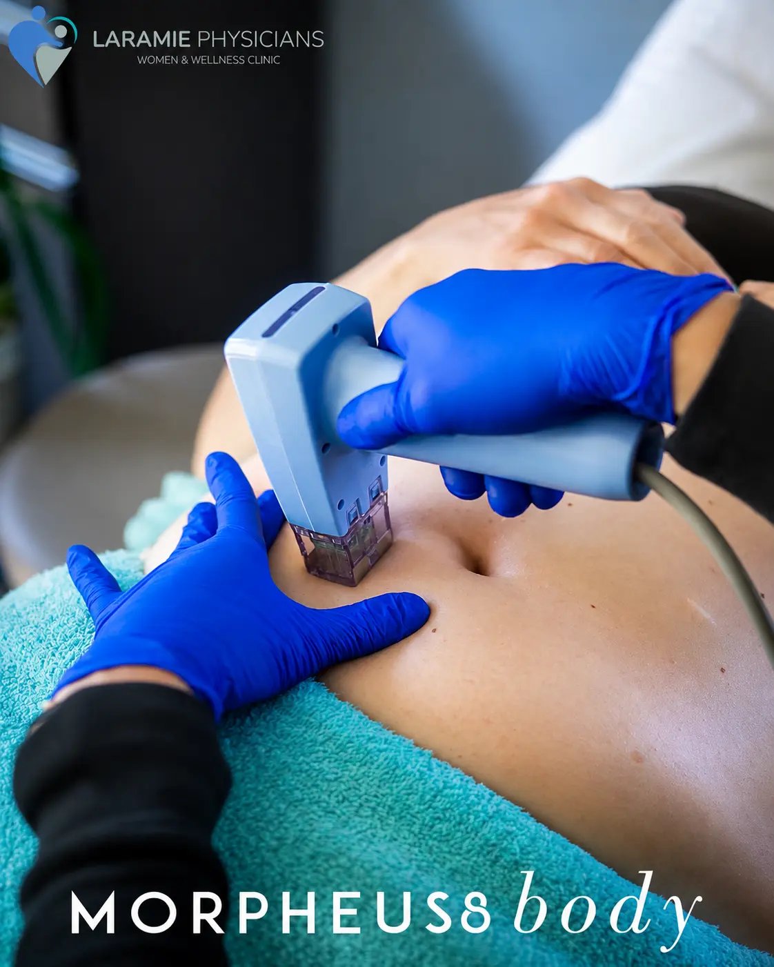 Morpheus8 Body radiofrequency microneedling treatment at LPWWC