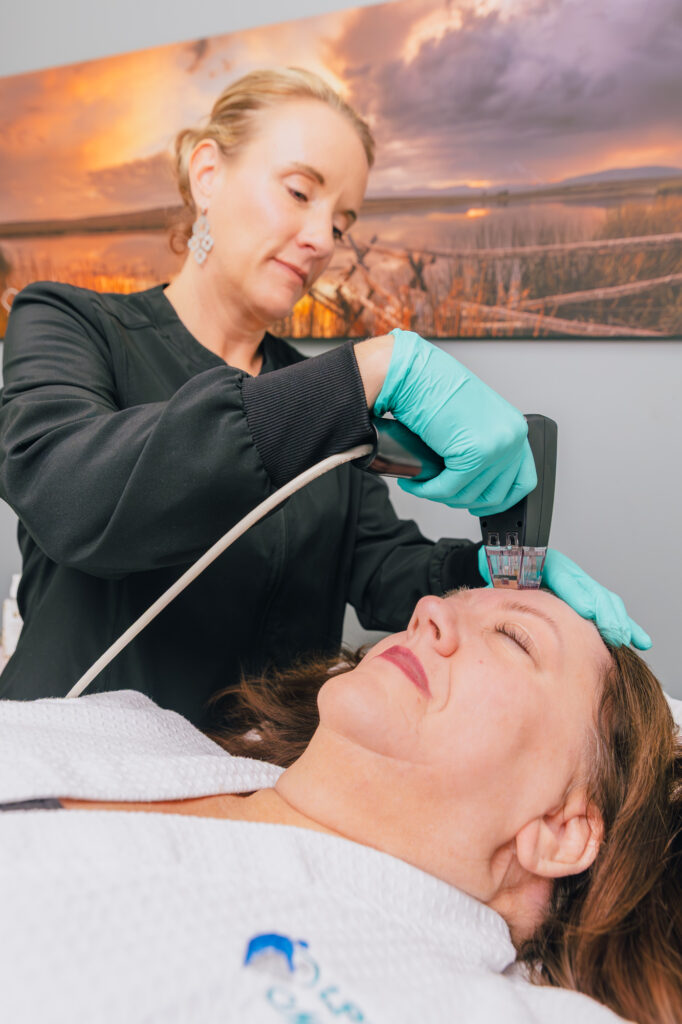 Patient relaxes while undergoing Morpheus8 RF microneedling in Laramie from a trusted LPWWC provider.
